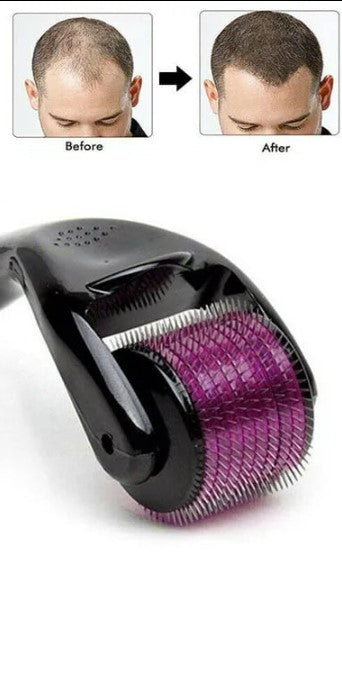 💎✨ (Pack of 3) Marble Jade Roller Combo – Glow, Tone & Refresh Your Skin Naturally 💖