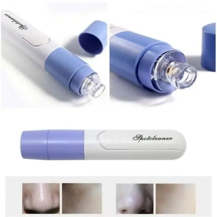 💆‍♀️✨ Electric Blackhead Remover Vacuum – Deep Pore Cleaner for Smooth, Clear & Glowing Skin 💖